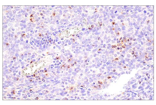 Immunohistochemistry Image 5: CCL5/RANTES (E9S2K) Rabbit Monoclonal Antibody
