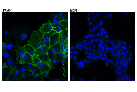 Immunofluorescence Image 1: N-Cadherin (13A9) Mouse Monoclonal Antibody