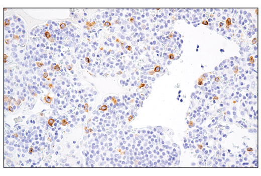 Immunohistochemistry Image 1: RHAMM/CD168 (E7S4Y) Rabbit Monoclonal Antibody (BSA and Azide Free)