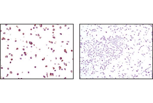 undefined Image 19: Cytokeratin Antibody Sampler Kit