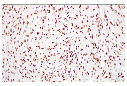 Immunohistochemistry Image 4: Rad50 (E4J5R) Rabbit Monoclonal Antibody