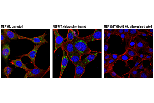 Immunofluorescence Image 1: SQSTM1/p62 (D6M5X) Rabbit Monoclonal Antibody