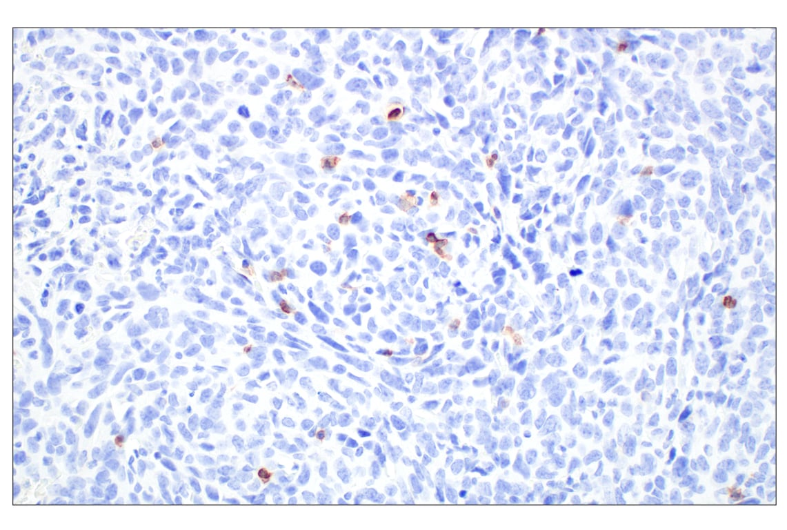Immunohistochemistry Image 2: CD6 (E9Q1V) Rabbit Monoclonal Antibody (BSA and Azide Free)