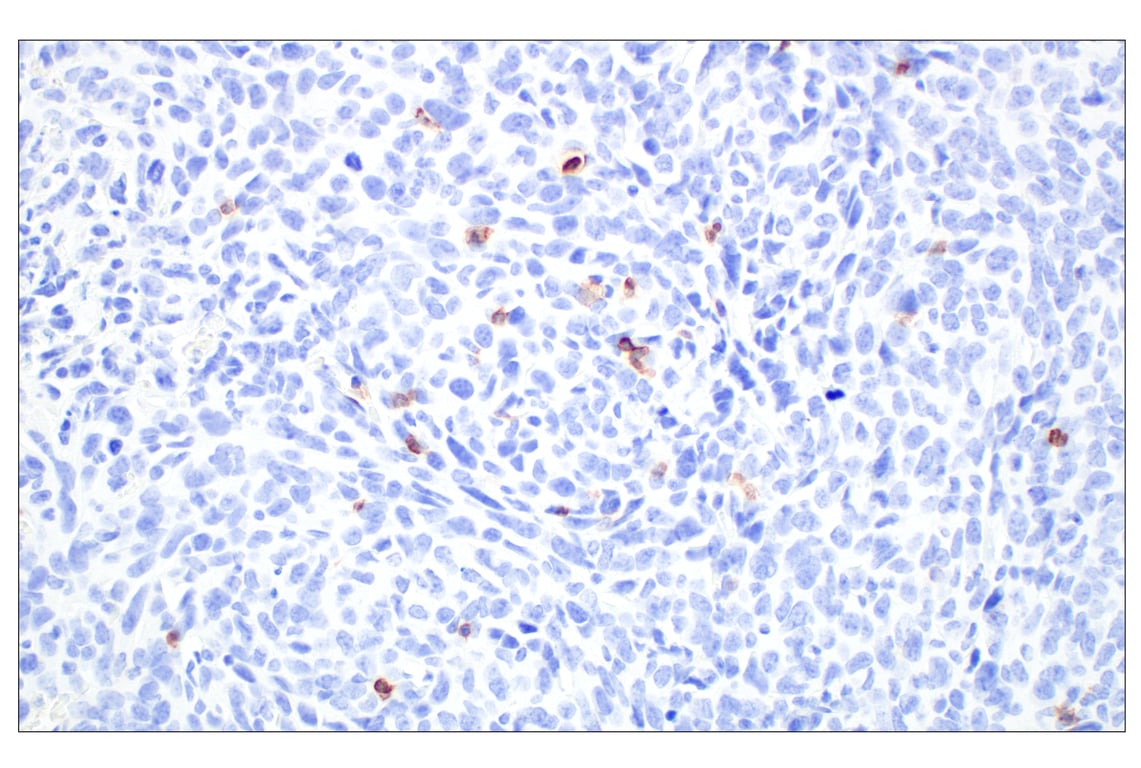 Immunohistochemistry Image 2: CD6 (E9Q1V) Rabbit mAb (BSA and Azide Free)