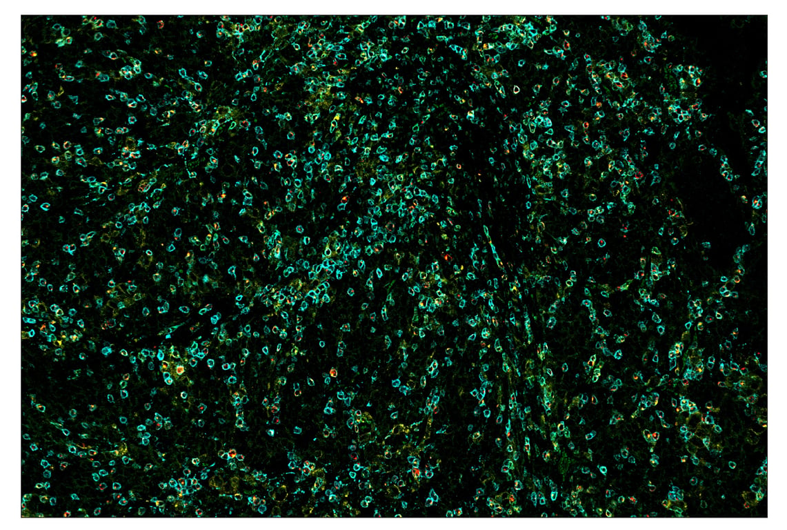 Immunohistochemistry Image 7: LAG3 (D2G4O<sup>™</sup>) & CO-0026-594 SignalStar<sup>™</sup> Oligo-Antibody Pair