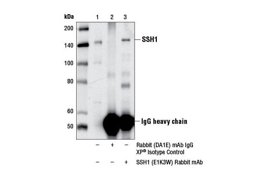 Immunoprecipitation Image 1: SSH1 (E1K3W) Rabbit Monoclonal Antibody