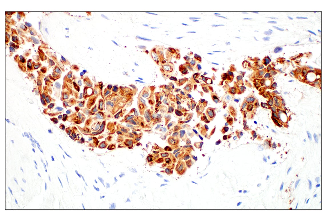 Immunohistochemistry Image 3: LPCAT1 (E4V4B) Rabbit Monoclonal Antibody