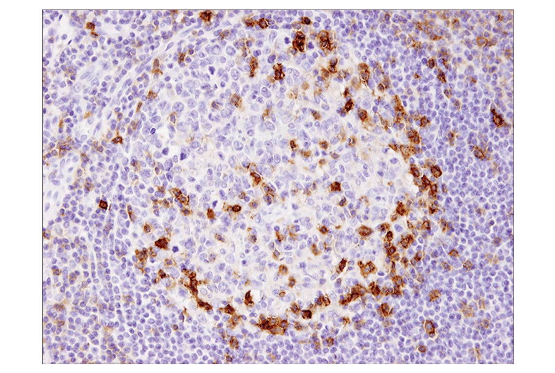Immunohistochemistry Image 4: ICOS (D1K2T<sup>™</sup>) Rabbit Monoclonal Antibody