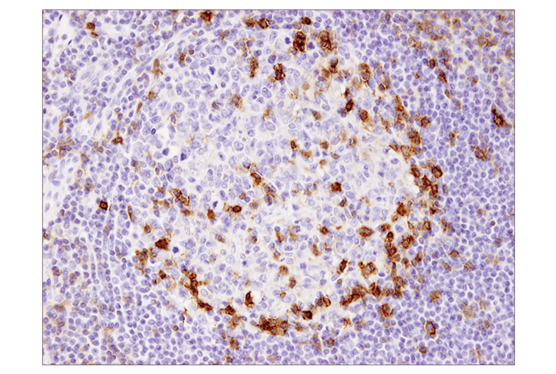 Immunohistochemistry Image 4: ICOS (D1K2T<sup>™</sup>) Rabbit mAb