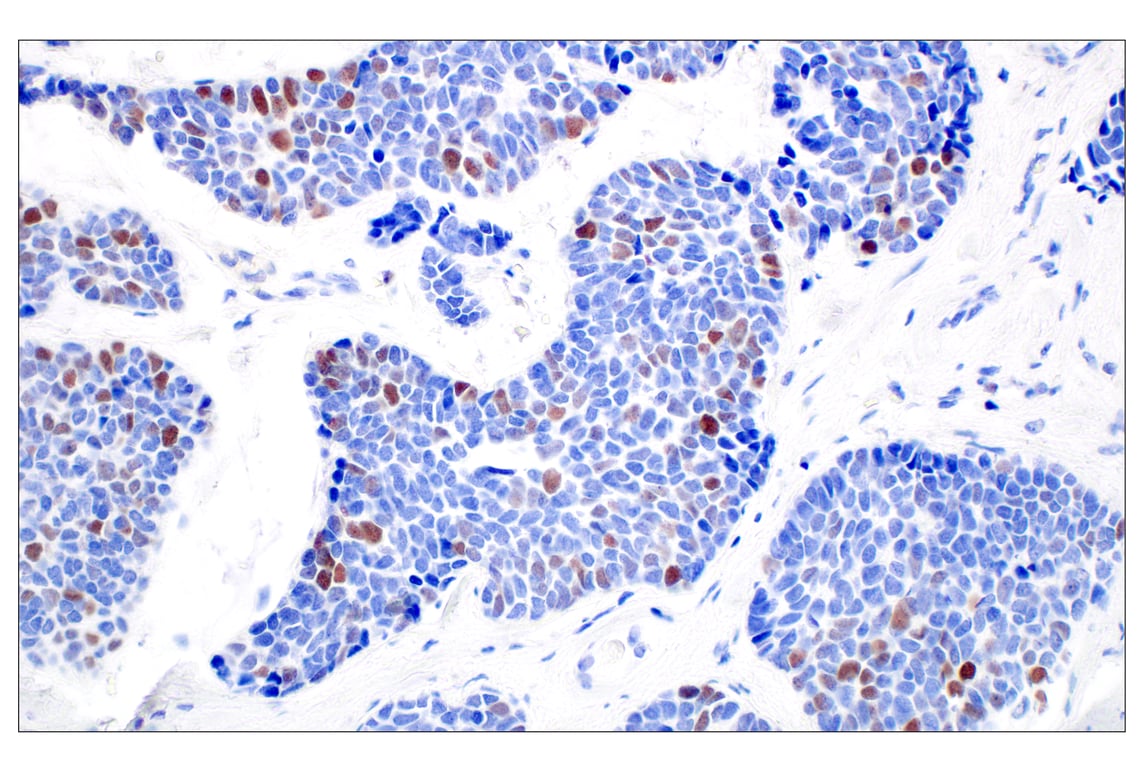 Immunohistochemistry Image 6: BRCA1 (E5S9G) Rabbit mAb (BSA and Azide Free)