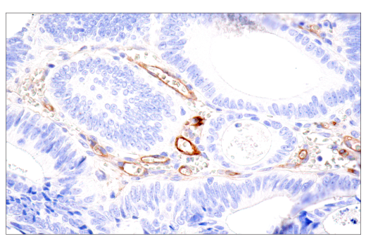 Immunohistochemistry Image 2: CD109 (E4I2V) Rabbit Monoclonal Antibody (BSA and Azide Free)
