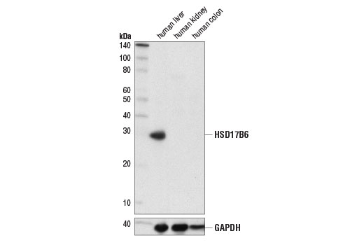 Western Blotting Image 1: HSD17B6 (D1T5H) Rabbit mAb