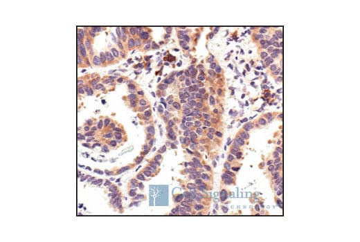 undefined Image 28: HSP/Chaperone Antibody Sampler Kit