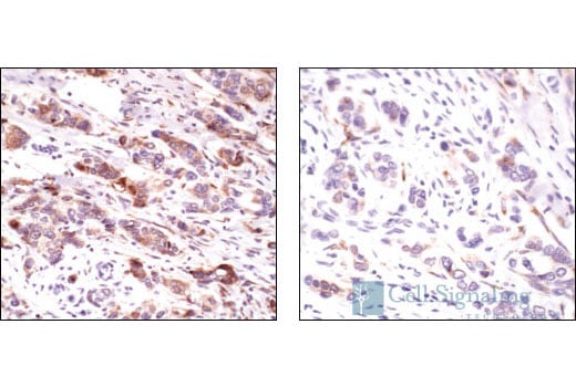 Immunohistochemistry Image 2: Phospho-S6 Ribosomal Protein (Ser235/236) Antibody