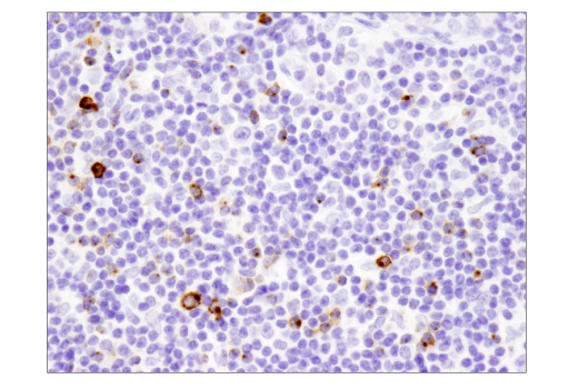 Immunohistochemistry Image 1: LAG3 (D2G4O) Rabbit Monoclonal Antibody (BSA and Azide Free)