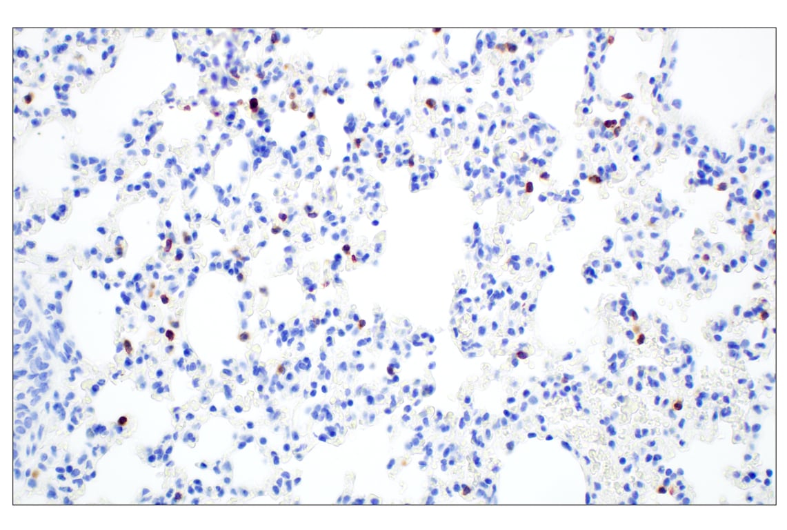 Immunohistochemistry Image 5: CD6 (E9Q1V) Rabbit Monoclonal Antibody (BSA and Azide Free)