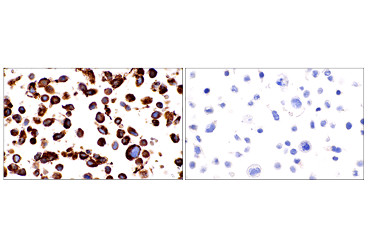 Immunohistochemistry Image 9: COL1A1 (E3E1X) Mouse Monoclonal Antibody (BSA and Azide Free)