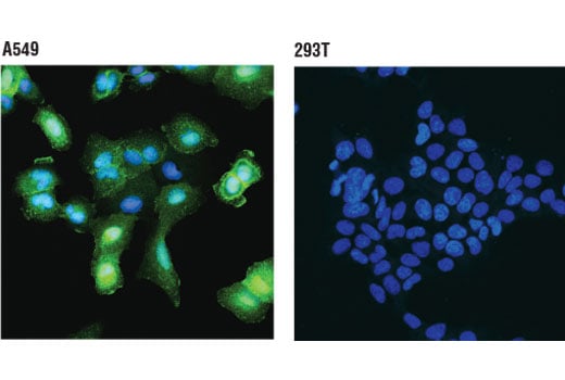 Immunofluorescence Image 1: Annexin A1 (D5V2T) XP<sup>®</sup> Rabbit mAb