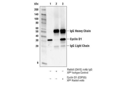 Immunoprecipitation Image 1: Cyclin D1 (E3P5S) Rabbit Monoclonal Antibody