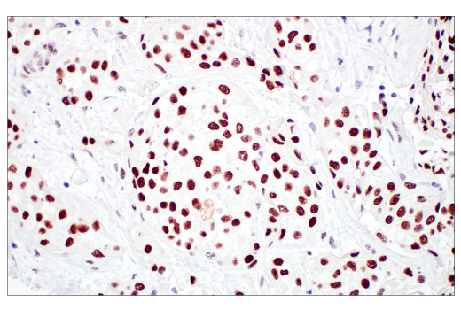 Immunohistochemistry Image 1: TIF1 alpha/TRIM24 (E9T3N) Rabbit Monoclonal Antibody