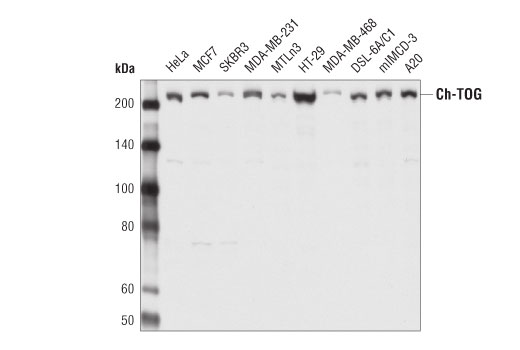 Western Blotting Image 2: Ch-TOG (D2Z8J) Rabbit Monoclonal Antibody