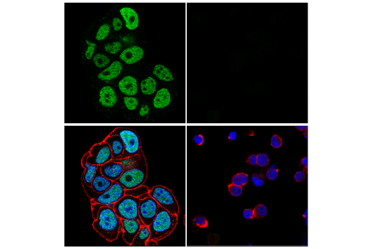 Immunofluorescence Image 1: ZNF217 (E6X4R) Rabbit Monoclonal Antibody