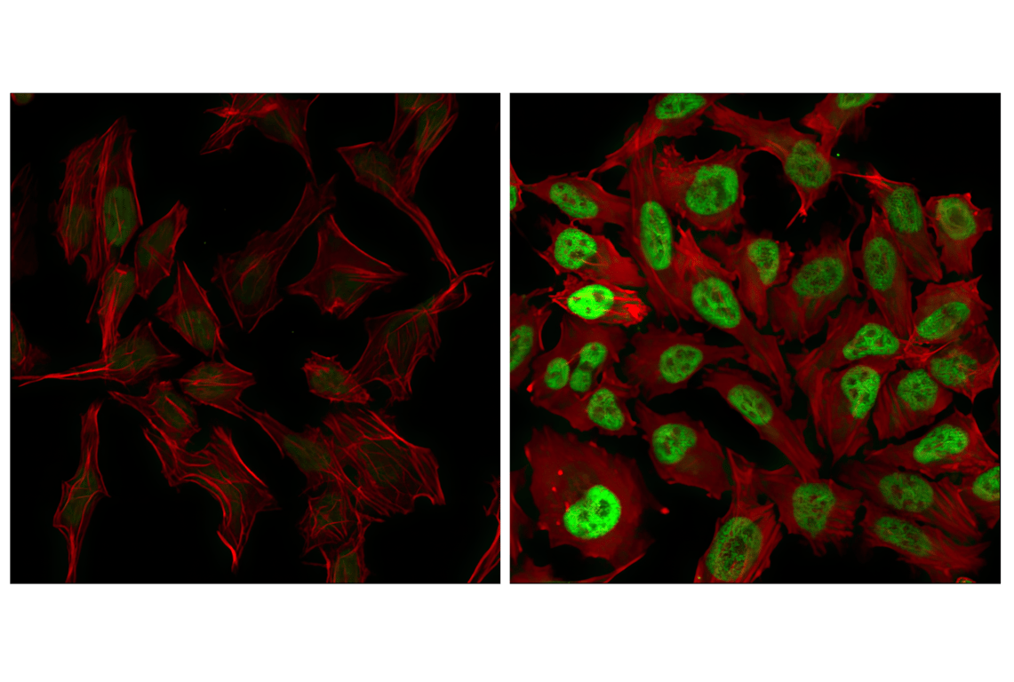 Immunofluorescence Image 1: c-Fos (9F6) Rabbit Monoclonal Antibody