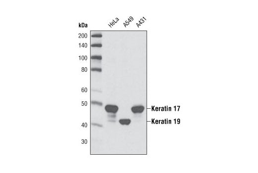 Western Blotting Image 1: Keratin 17/19 (D32D9) XP<sup>®</sup> Rabbit mAb