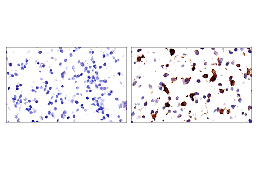 Immunohistochemistry Image 1: DNAM-1/CD226 (E8L9G) Rabbit Monoclonal Antibody