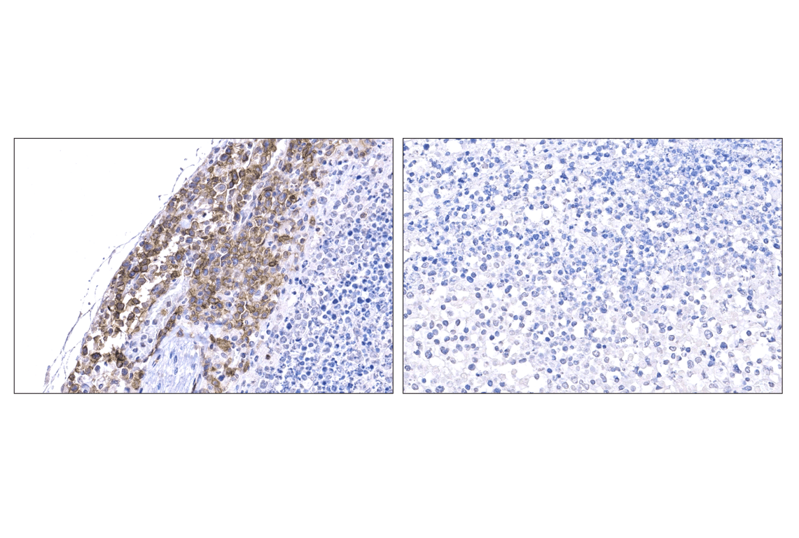 Immunohistochemistry Image 1: Whitlow/218 Linker (F2G3S) Rabbit Monoclonal Antibody