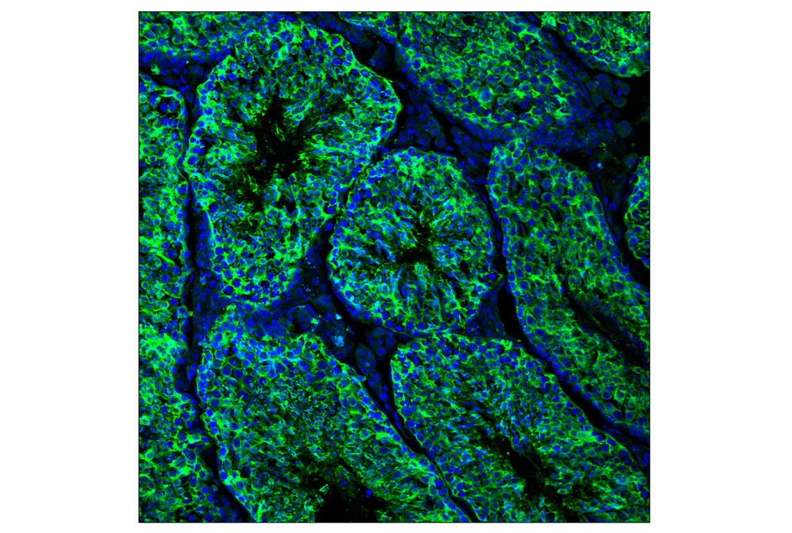 Immunofluorescence Image 1: alpha-Tubulin (11H10) Rabbit Monoclonal Antibody