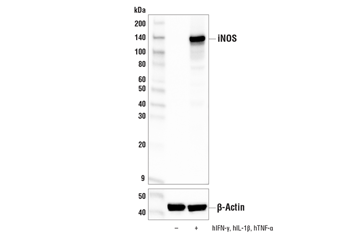 Western Blotting Image 1: iNOS (E3W6B) Rabbit mAb