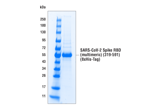 バラ売り可 DUALEFFECTTOXSERUM TOXVOLUMESERUM SARS-CoV-2 Spike RBD (multimeric) (319-591) Recombinant