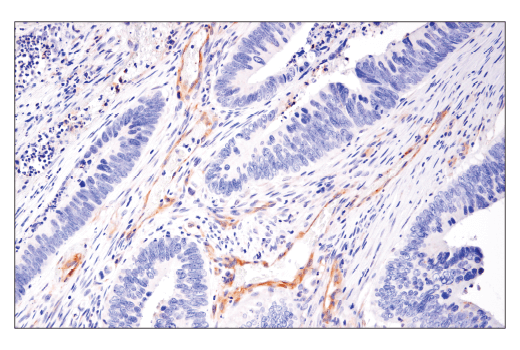 Immunohistochemistry Image 1: LC3B (E5Q2K) Mouse Monoclonal Antibody (BSA and Azide Free)
