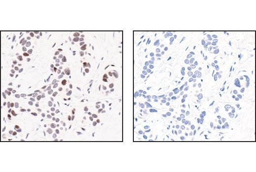 undefined Image 7: Phospho-SAPK/JNK Pathway Antibody Sampler Kit
