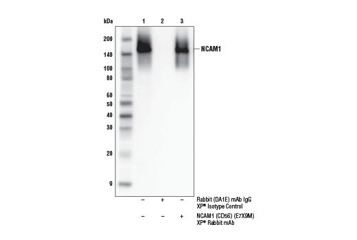 Immunoprecipitation Image 1: NCAM1 (CD56) (E7X9M) Rabbit Monoclonal Antibody