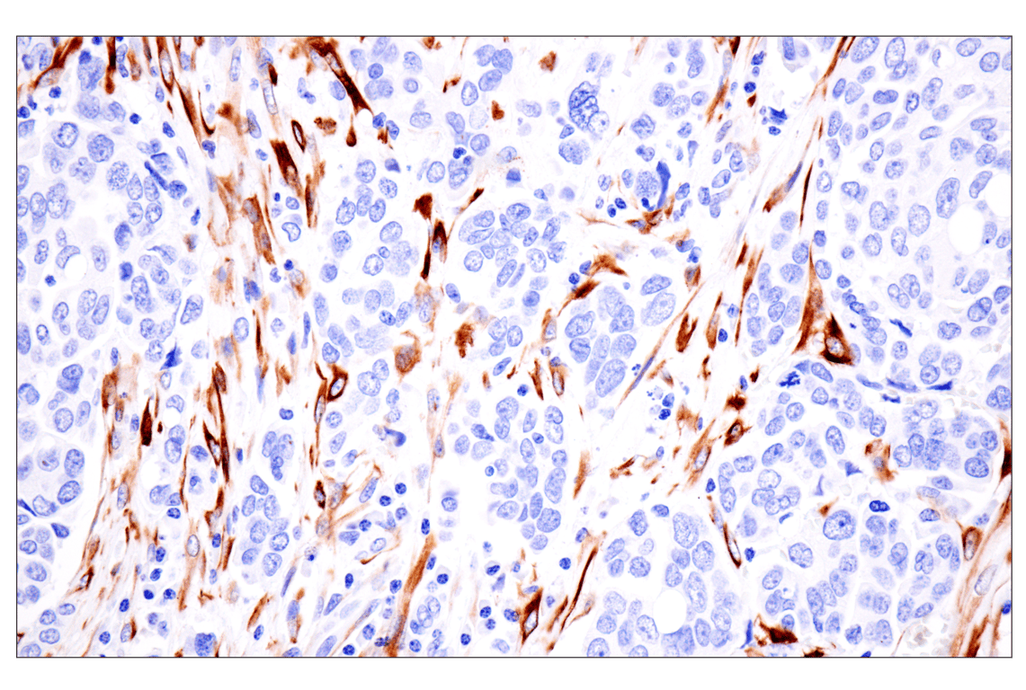 Immunohistochemistry Image 6: Desmin (F5V4I) Rabbit Monoclonal Antibody