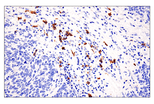 Immunohistochemistry Image 4: CD20 (E7B7T) Rabbit Monoclonal Antibody (BSA and Azide Free)