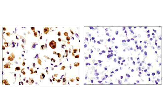 Immunohistochemistry Image 5: Galectin-1/LGALS1 (D608T) Rabbit Monoclonal Antibody (IHC Formulated)