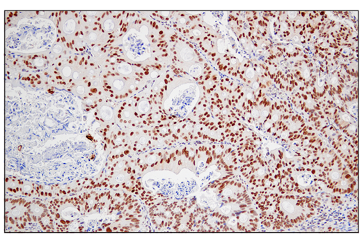 Immunohistochemistry Image 1: JMJD6 (D3O3N) Rabbit Monoclonal Antibody