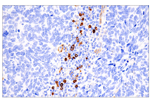 Immunohistochemistry Image 2: IL3RA/CD123 (BR4MS) Mouse Monoclonal Antibody