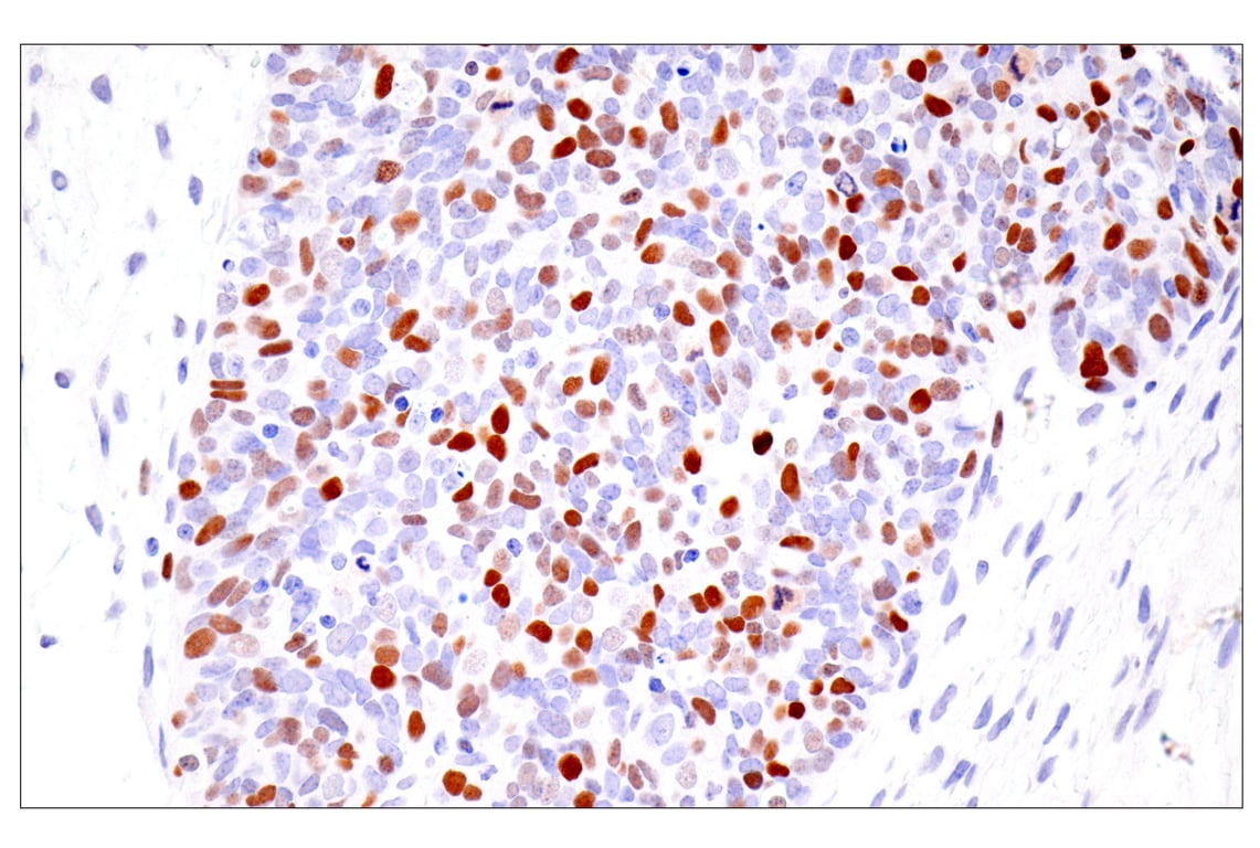 Immunohistochemistry Image 3: UHRF1 (E5W8W) Rabbit Monoclonal Antibody