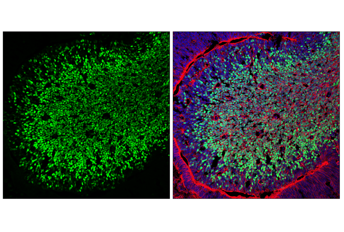 Immunofluorescence Image 1: DLX1 (E4T1L) Rabbit Monoclonal Antibody