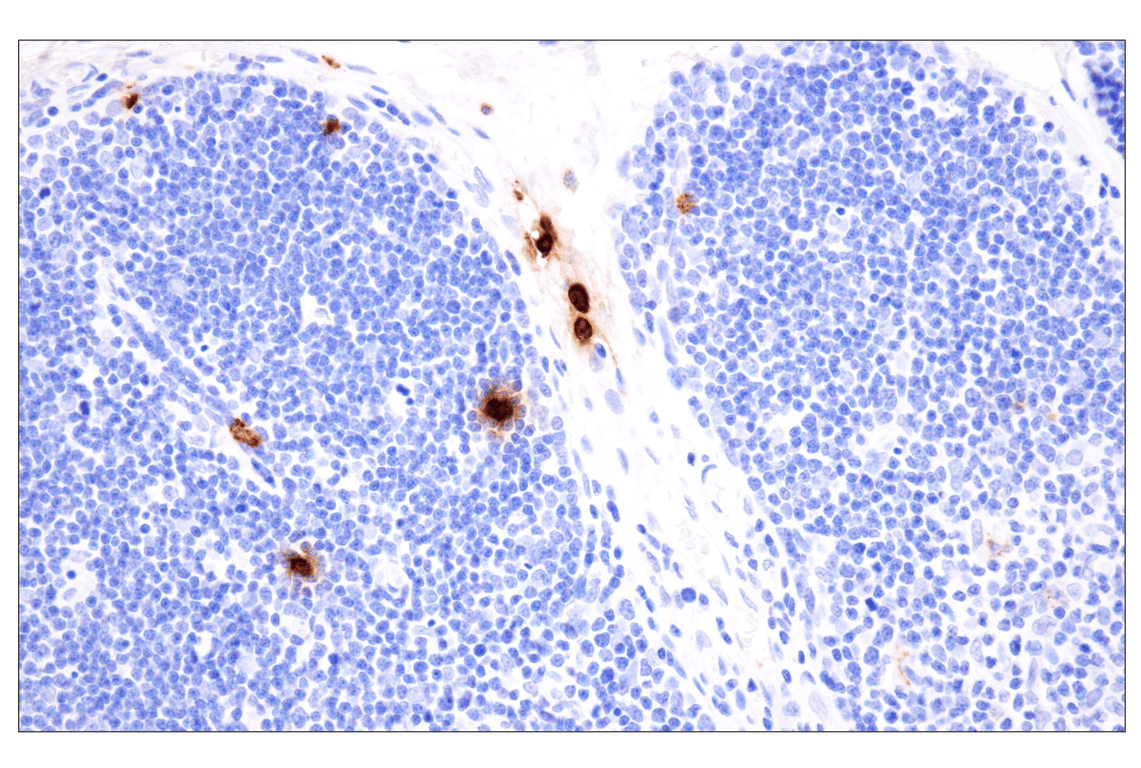 Immunohistochemistry Image 7: Neutrophil Elastase (F4H3X) Rabbit Monoclonal Antibody