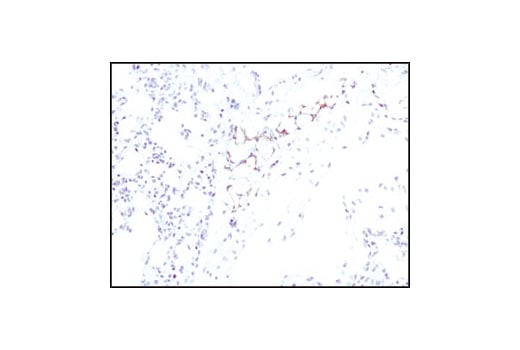 Immunohistochemistry Image 3: ATGL (30A4) Rabbit Monoclonal Antibody