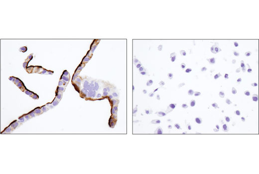 Immunohistochemistry Image 5: CD133 (D4W4N) Rabbit Monoclonal Antibody