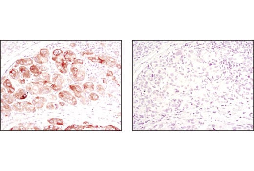 Immunohistochemistry Image 1: Acetyl-CoA Carboxylase (C83B10) Rabbit Monoclonal Antibody (BSA and Azide Free)