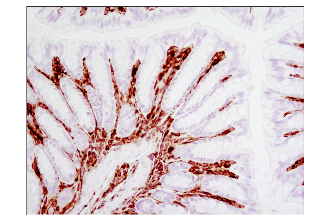 Immunohistochemistry Image 2: Vimentin (D21H3) Rabbit Monoclonal Antibody (BSA and Azide Free)