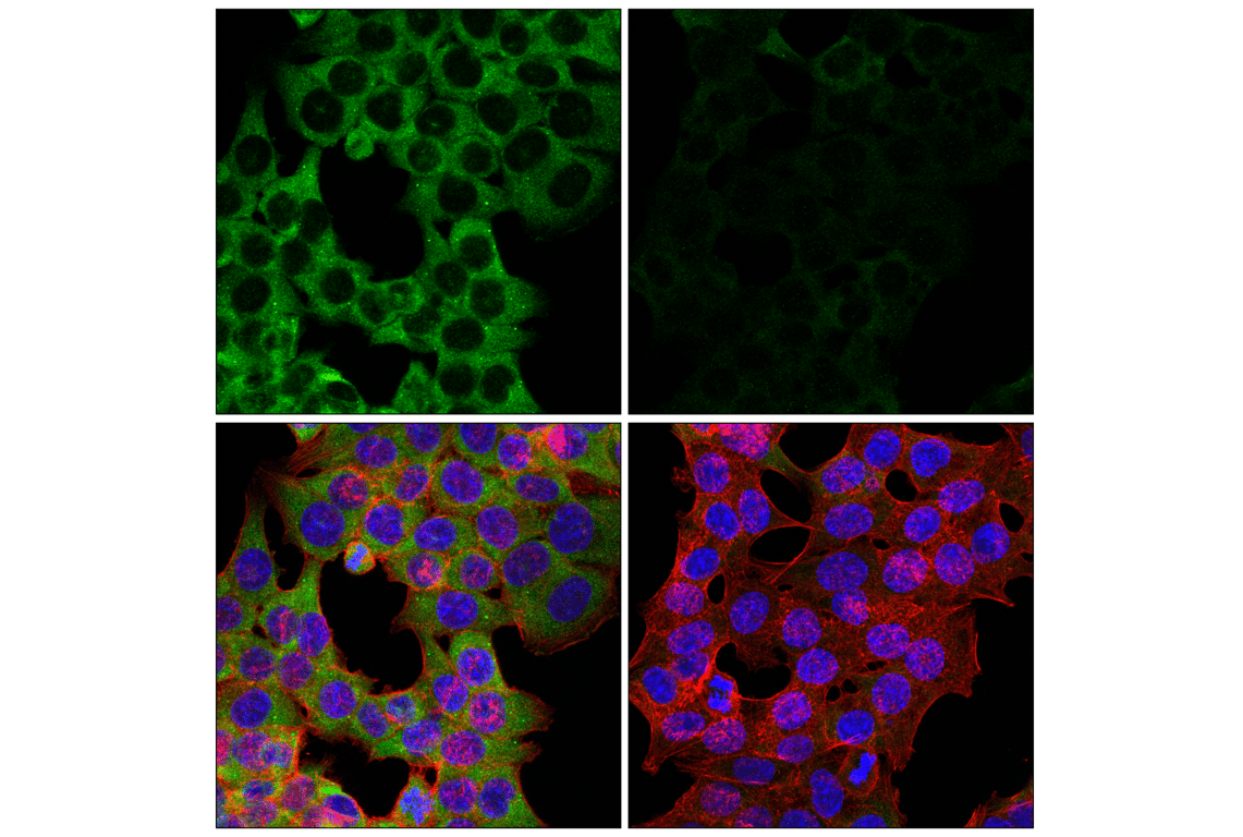 Immunofluorescence Image 1: YTHDF3 (E2J9I) Rabbit Monoclonal Antibody