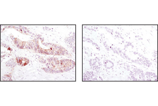 Immunohistochemistry Image 1: Phospho-4E-BP1 (Thr37/46) (236B4) Rabbit Monoclonal Antibody (BSA and Azide Free)